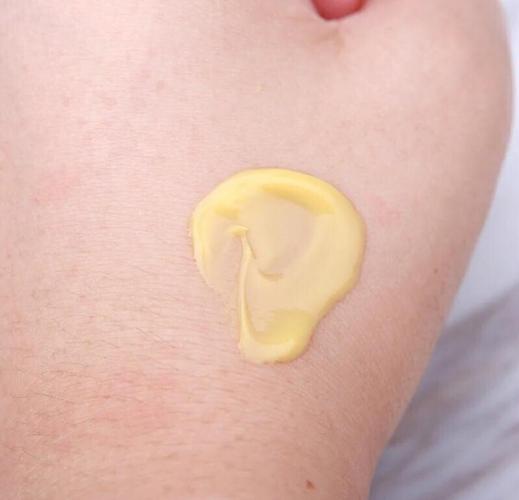 美国果酸祛痘印产品效果怎么样？-图3