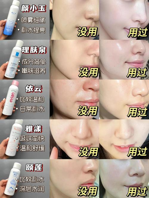 自制补水喷雾能祛痘印吗？-图1