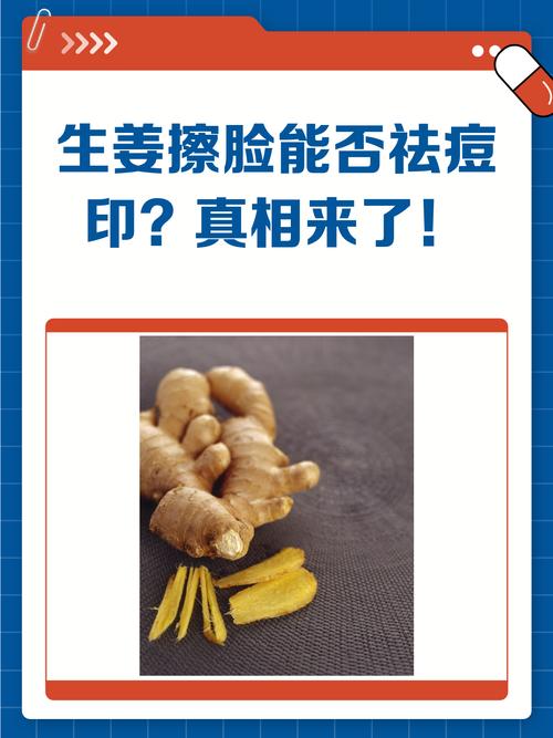 生姜祛痘能每天用吗？-图1