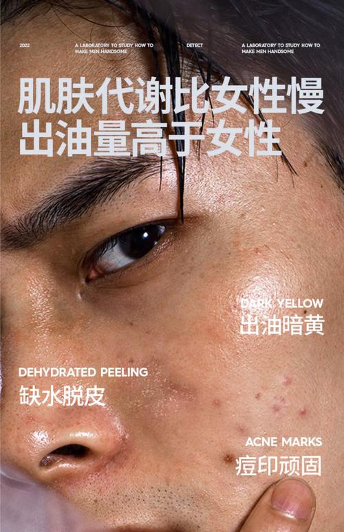 男士祛痘印产品选哪个好？-图3