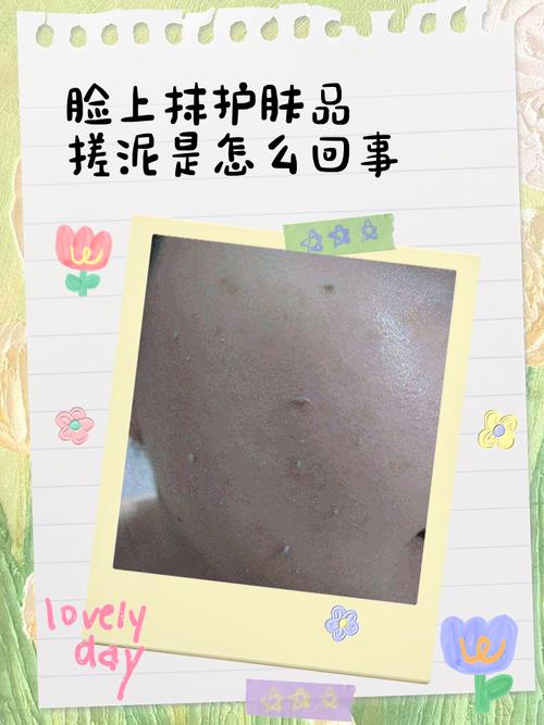 香蕉泥能消炎祛痘吗?-图2 香蕉泥能消炎祛痘吗?-图2