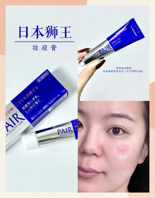 狮王祛痘膏容易过敏么-图1 狮王祛痘膏容易过敏么-图1