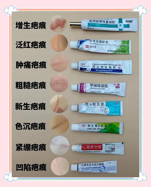 祛痘印疤痕，哪种方法最有效？-图2