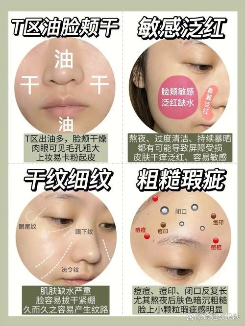 内干外油的皮肤护肤品-图1