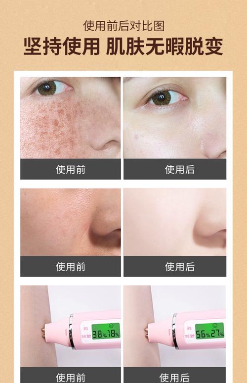 祛斑护肤品怎么选才有效？-图2