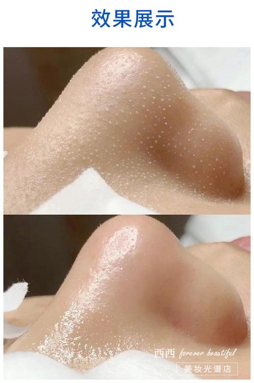 去黑头缩毛孔，护肤品真能同时搞定吗？-图1