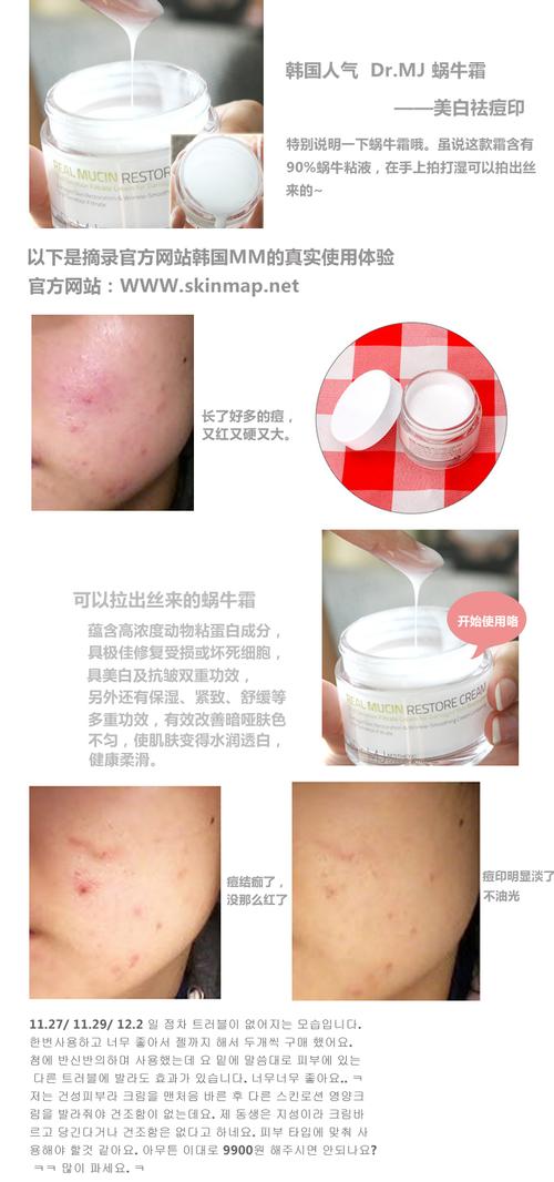 蜗牛霜祛痘印多久能见效？-图1