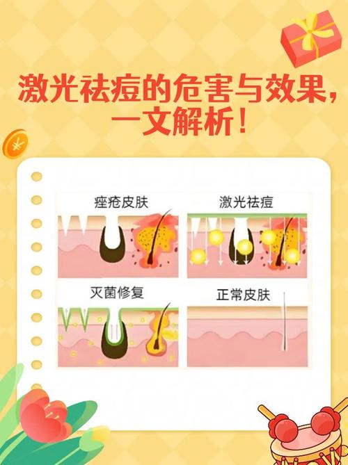 红蓝光祛痘有哪些副作用？-图2