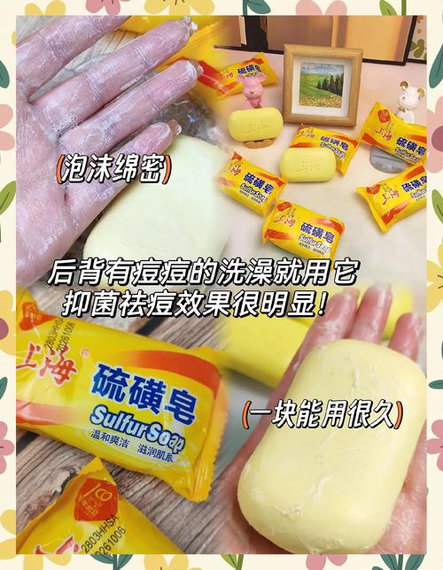 硫磺皂哪个牌子祛痘最有效？-图2