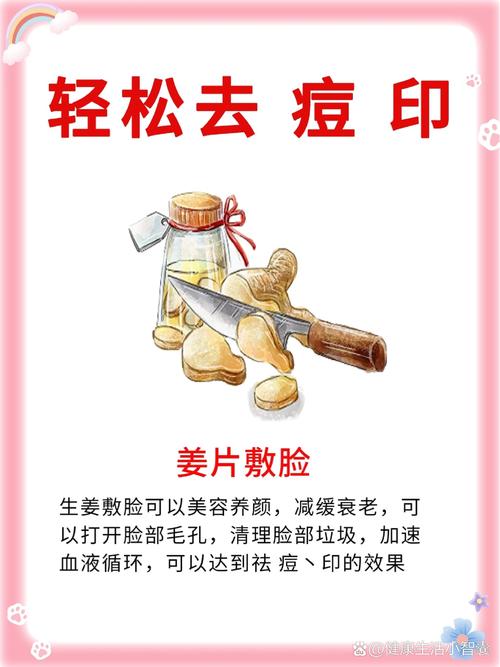 生姜祛痘印会留疤或刺激皮肤吗?-图1 生姜祛痘印会留疤或刺激皮肤吗?-图1