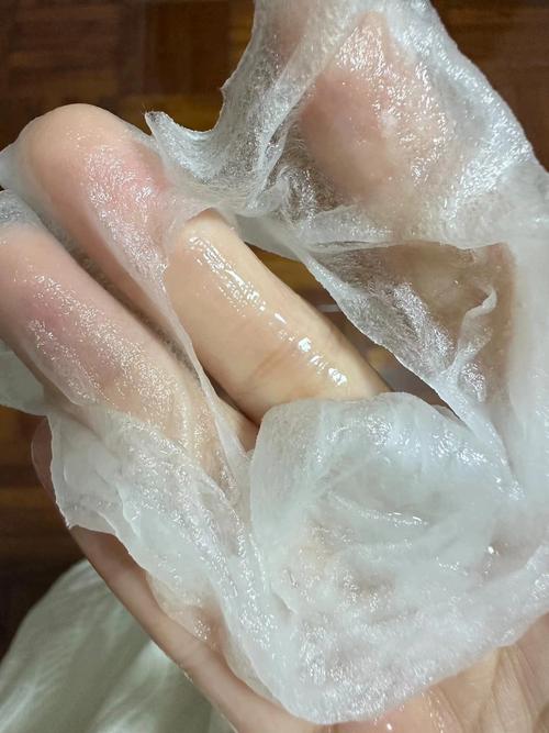 祛痘补水面膜怎么选？-图3