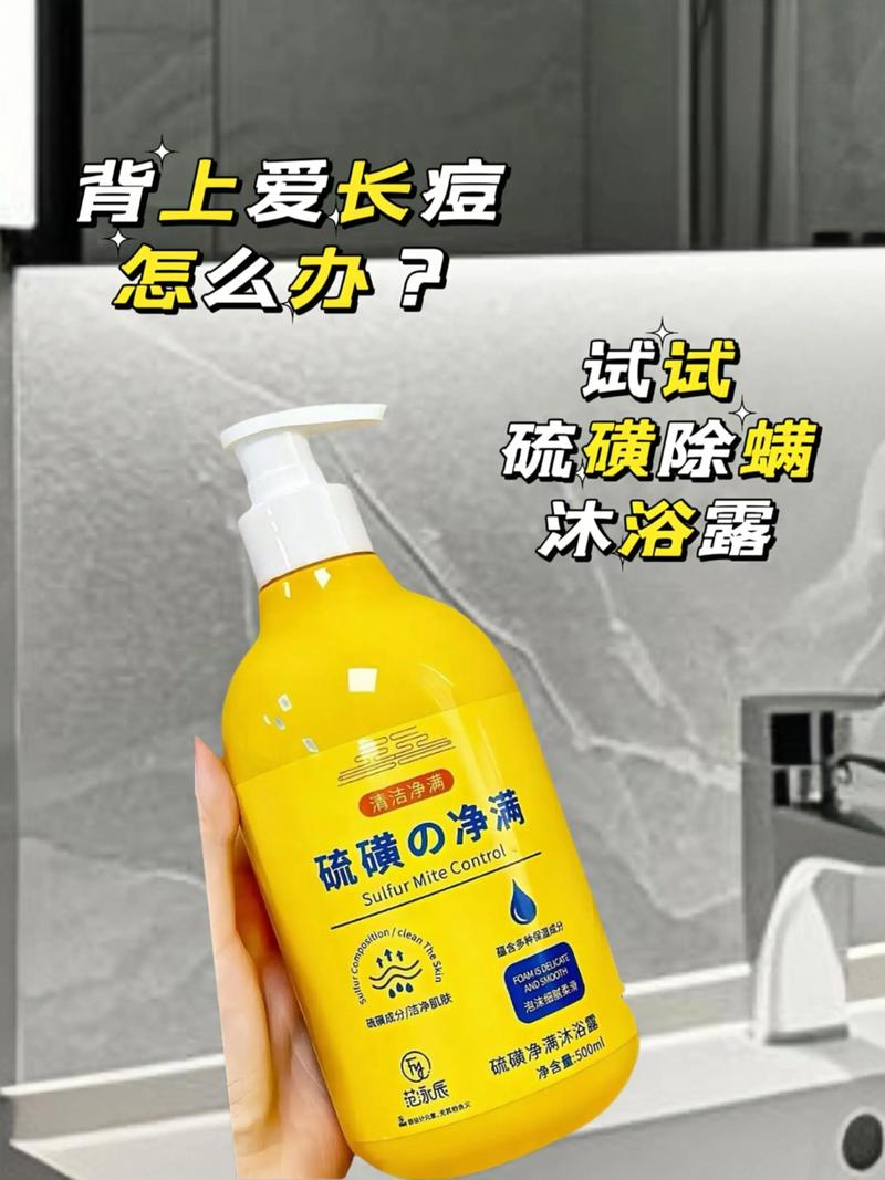 硫磺皂洗脸能祛痘印吗？-图1