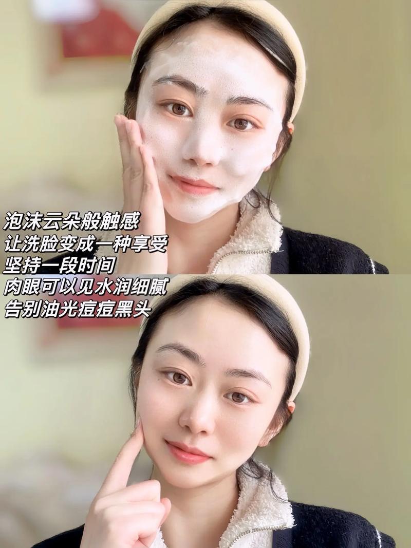 硫磺皂洗脸能祛痘印吗？-图3