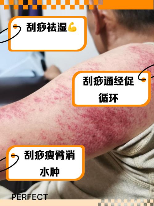 l刮痧真的可以祛痘吗-图1