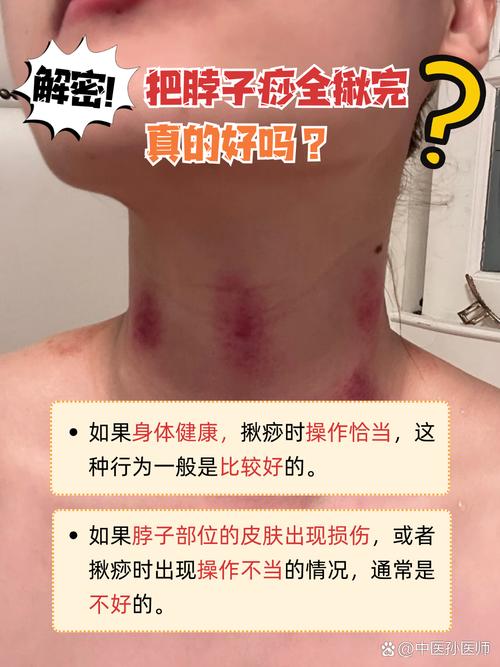 l刮痧真的可以祛痘吗-图3