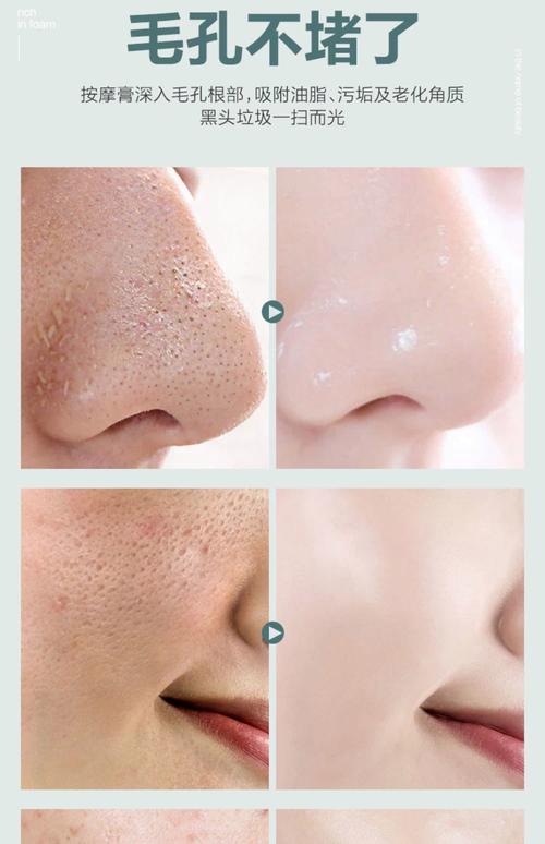 毛孔适合用什么护肤品?-图3 毛孔适合用什么护肤品?-图3