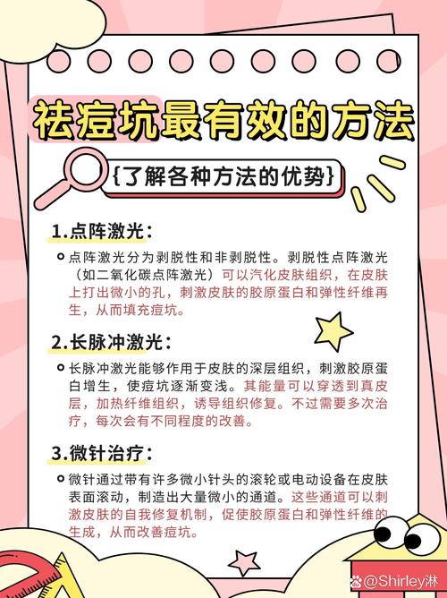 激光祛痘具体怎么做？-图2