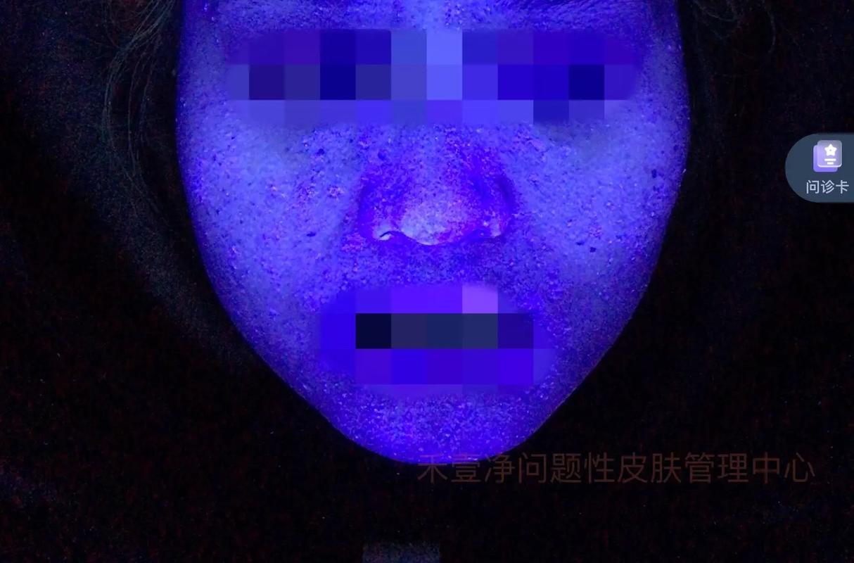 护肤品有荧光剂吗？-图2