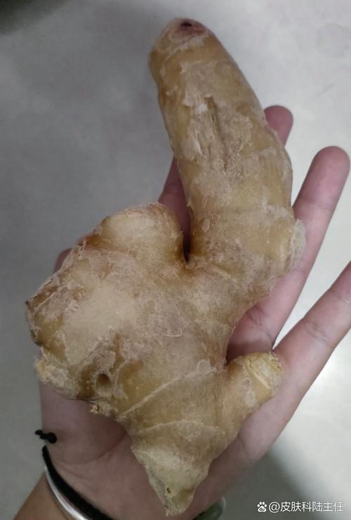 姜汁祛痘印真有效吗？-图2