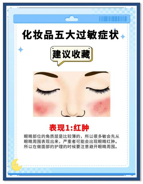 护肤品过敏多久能好？-图2