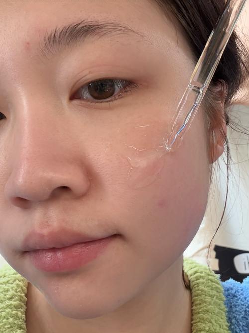 护肤营养过剩会长痘吗？-图3