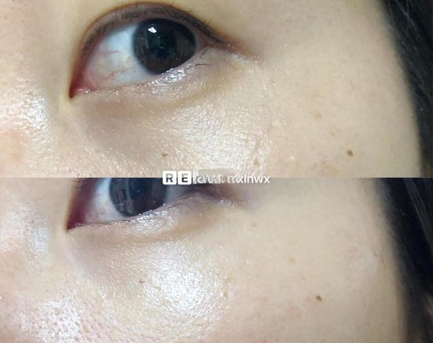 护肤步骤，水乳和眼霜谁先用？-图2