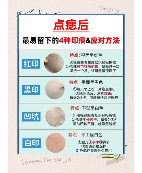 点痣后多久能恢复护肤？-图2