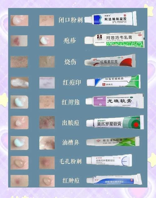 用什么护肤产品祛痘快-图1