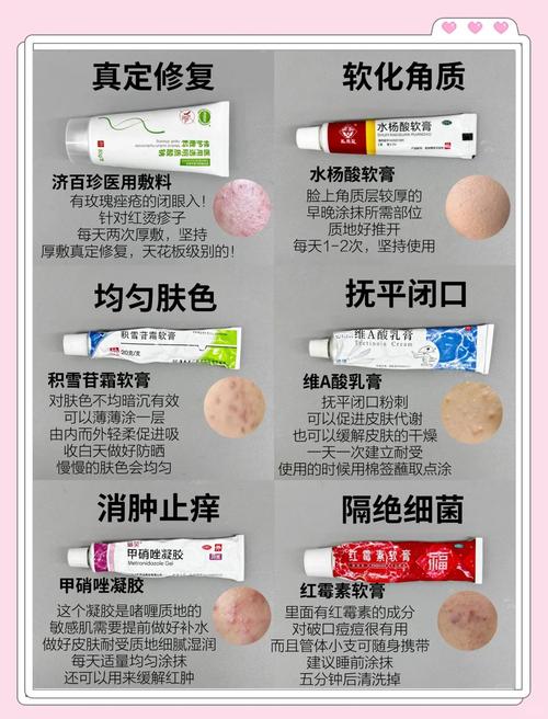 祛痘产品每日使用有必要吗？-图3