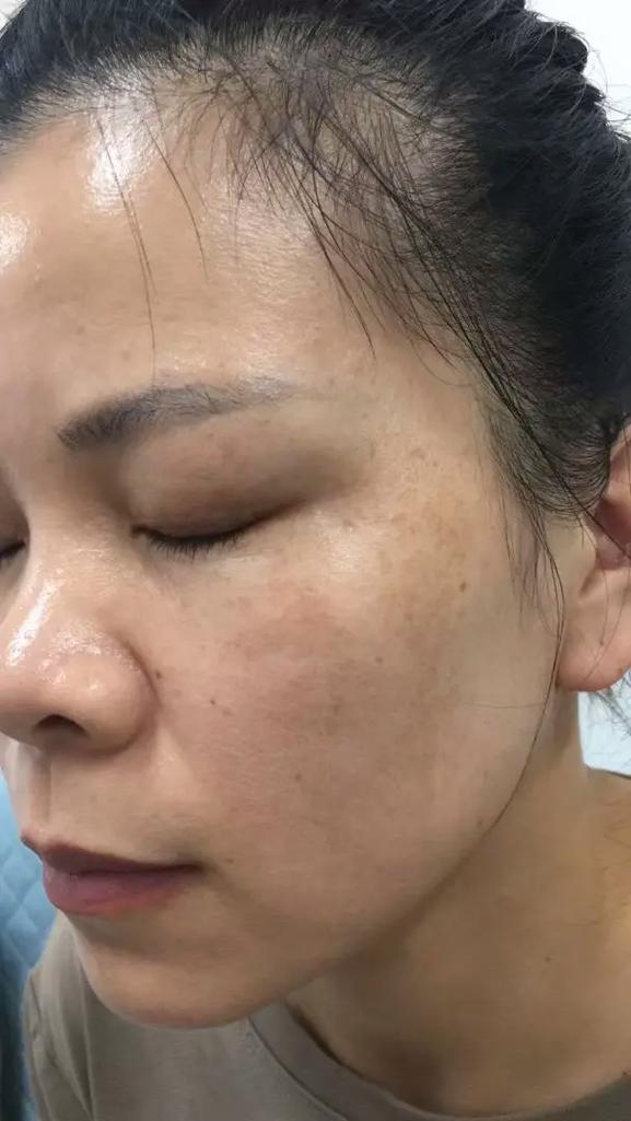 皮肤不吸收护肤品怎么办？-图1