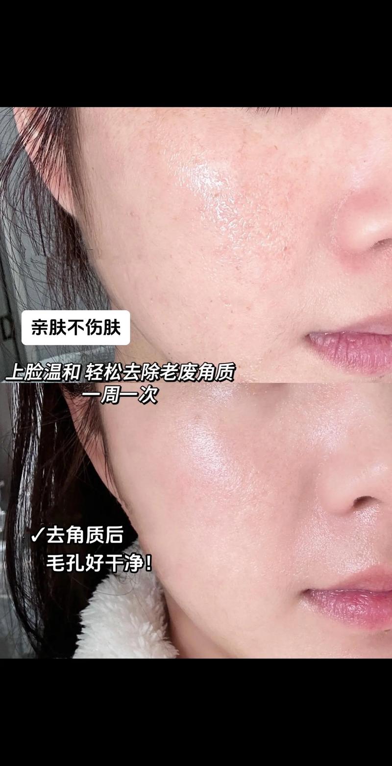 皮肤不吸收护肤品怎么办？-图3