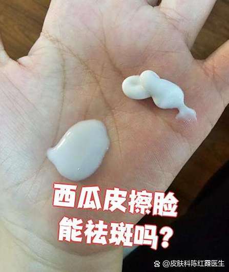 西瓜皮真能祛痘印祛斑吗？-图1