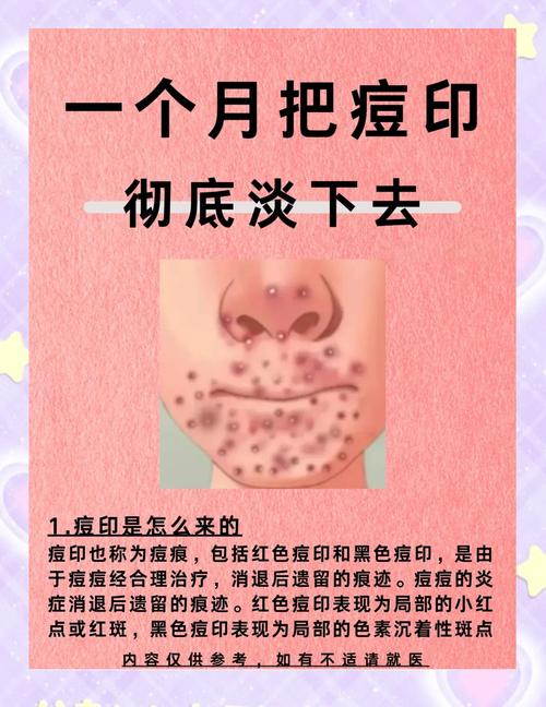 祛痘和祛印能同时进行吗？-图2