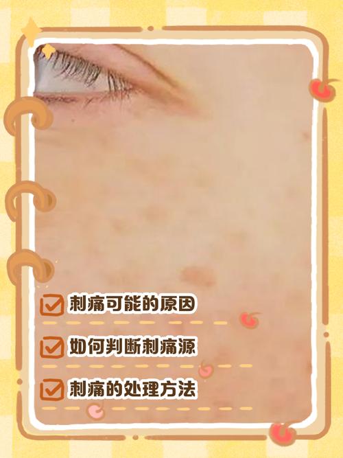 护肤品用后脸刺痛，为何会这样？-图3