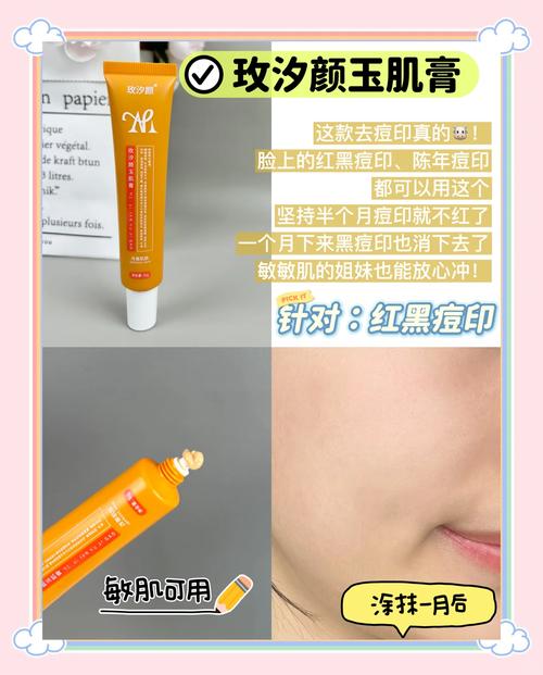 pair祛痘膏到底有哪些功效？-图2