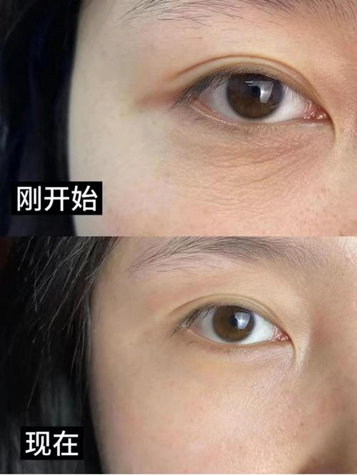 护肤先涂眼霜还是精华-图2