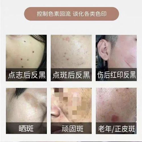 瓷肌护肤品一套多少钱？-图1