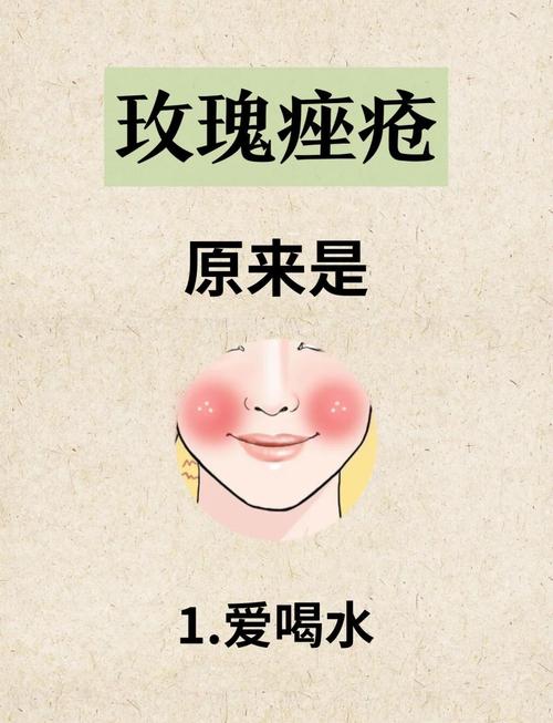 祛痘本草纲目为何不能？-图2