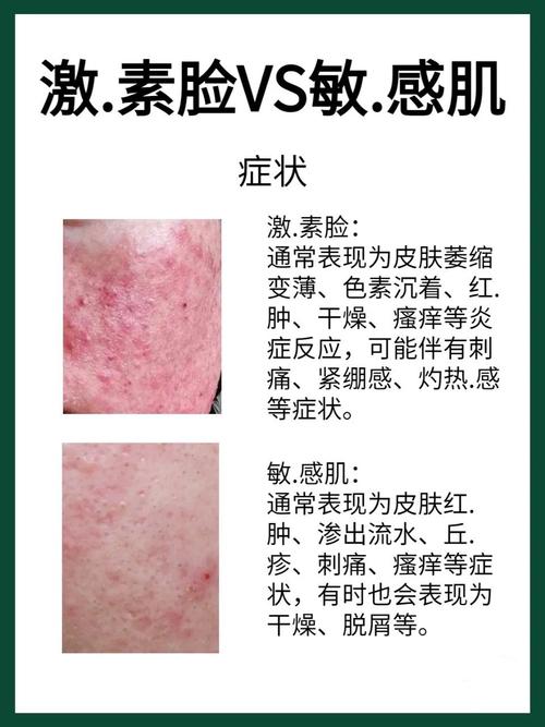 护肤品含激素会有什么危害？-图1