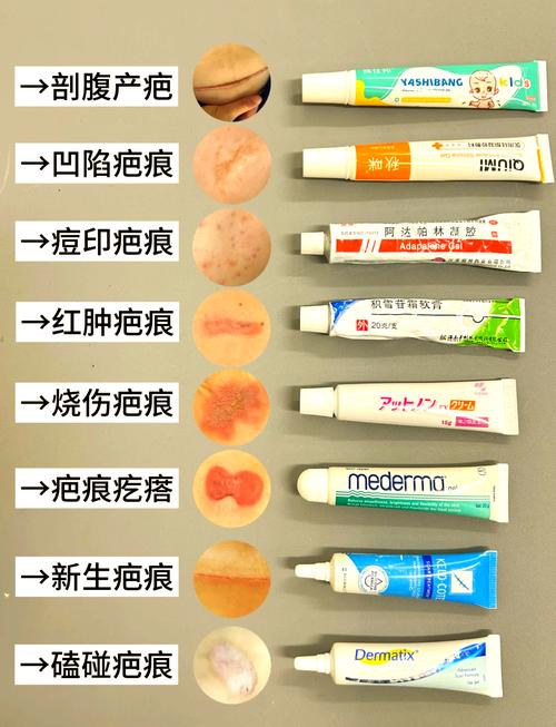 去疤痕护肤品，到底哪款才真正有效？-图3