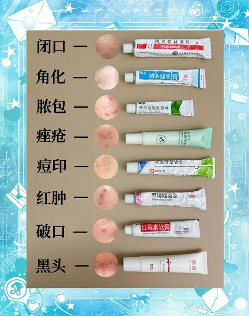 什么牙膏祛痘效果最好？-图3