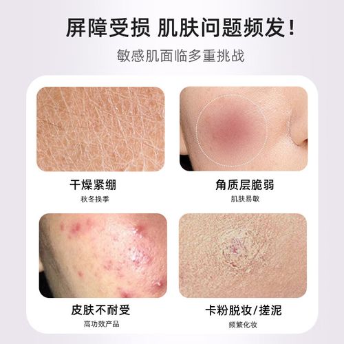 珂语护肤品真的好用吗？-图3