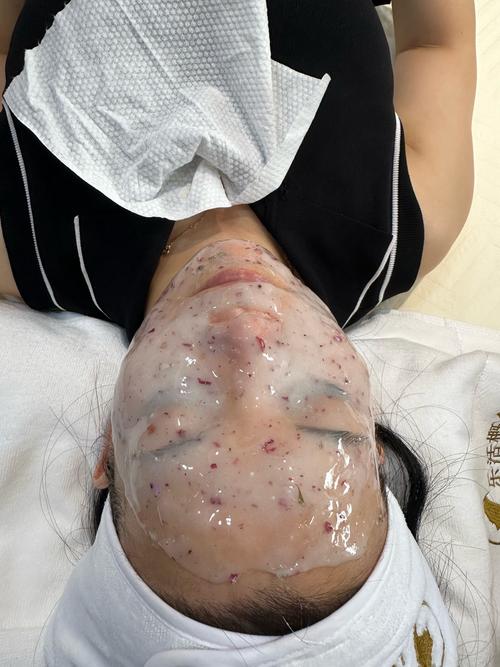 杭州华山美容医院祛痘-图2