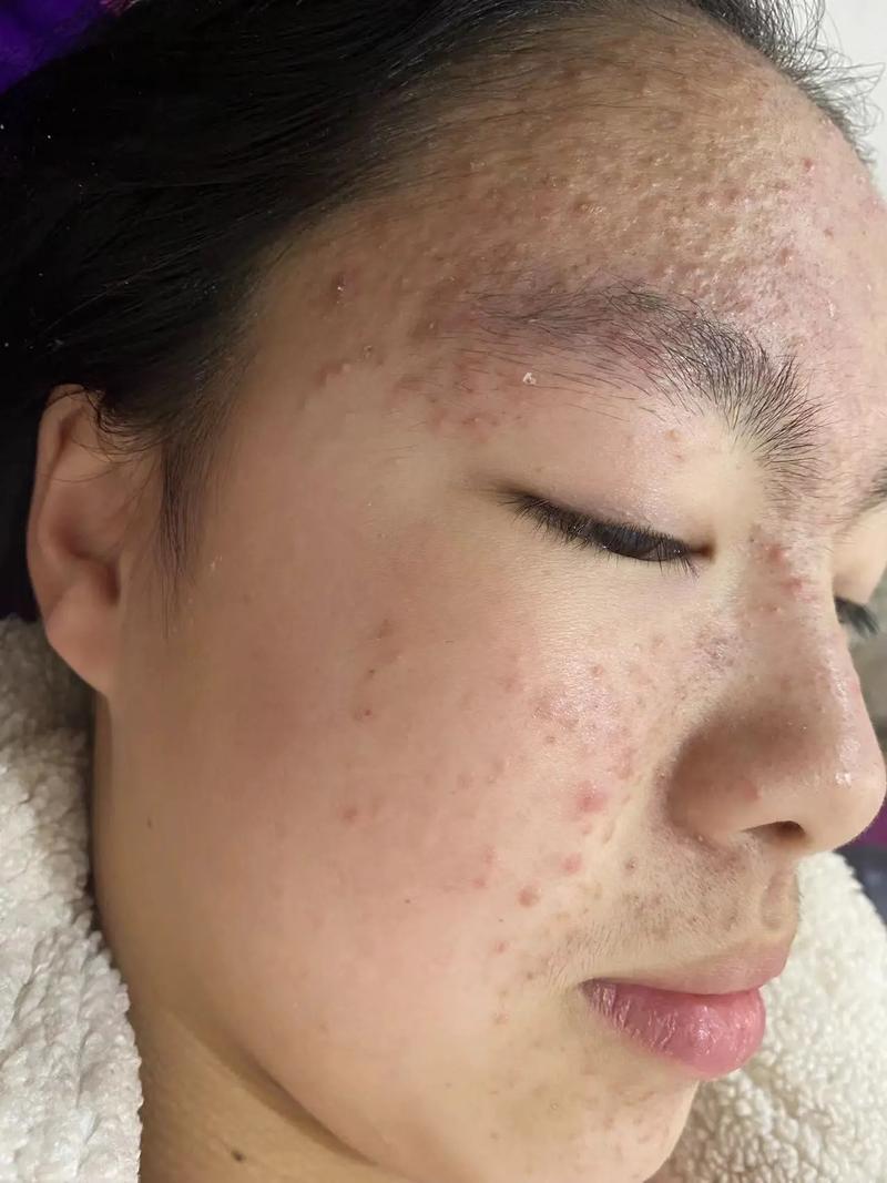 肌龄护肤品有严重问题-图1