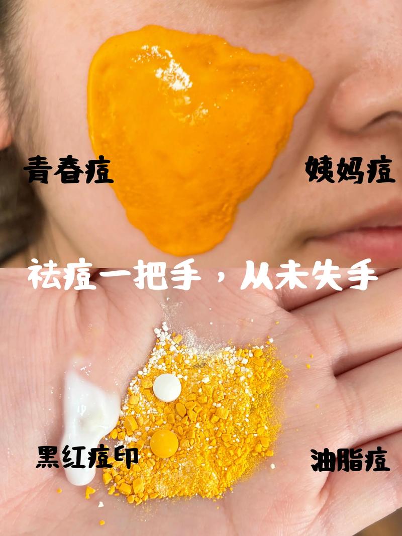 自己做的孕妇祛痘方法安全有效吗？-图2