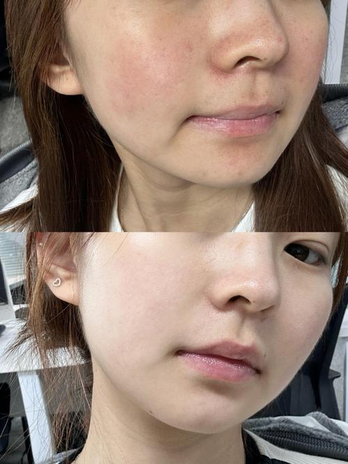 护肤品涂完脸黏腻怎么办?-图1 护肤品涂完脸黏腻怎么办?-图1