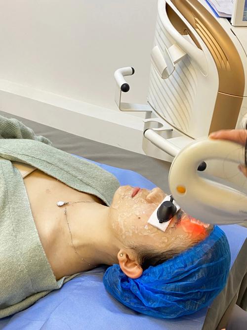 激光祛痘印和光子嫩肤哪个更适合你？-图1