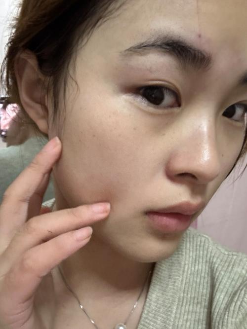 护肤品擦脸辣辣的是怎么回事？-图1