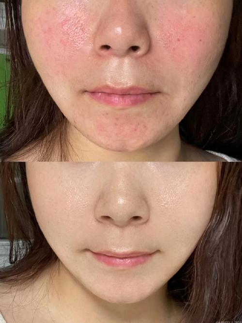 护肤品擦脸辣辣的是怎么回事？-图3