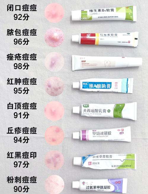 祛痘最快最好的品牌是哪个？-图1